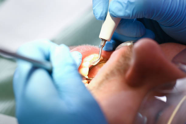 Best Tooth Infection Emergency Dentist  in Felida, WA