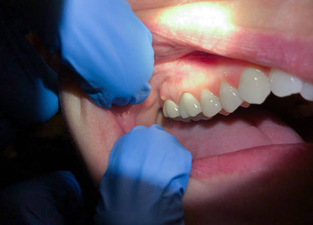 Best Emergency Gum Pain Relief  in Felida, WA